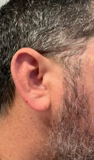 Hablemos de algo muy importante: la salud auditiva. En este artículo, te compartiré consejos prácticos para cuidar tus oídos y mantener una excelente audición y mejorar tu calidad de vida.
